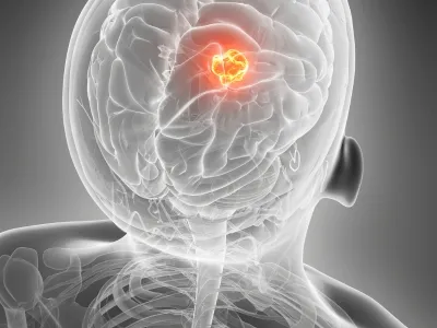 Head & Neck Cancer